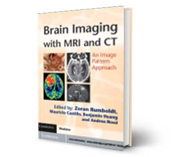 Brain Imaging With MRI and CT Reference Book