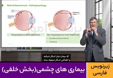 آموزش بیماری های چشمی (بخش خلفی)