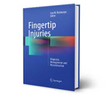 Fingertip Injuries Diagnosis, Management and Reconstruction Reference Book