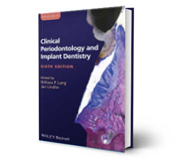 Clinical Periodontology And Implant Dentistry Reference Book