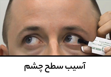 آسیب سطح چشم